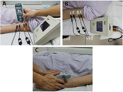 Quantifying the Changes of Mechanical and Electrical Properties of Paralyzed Muscle in Survivors With Cervical Spinal Cord Injury